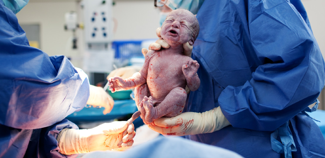 baby being born via caesarean section 2024 12 05 17 53 54 utc 1